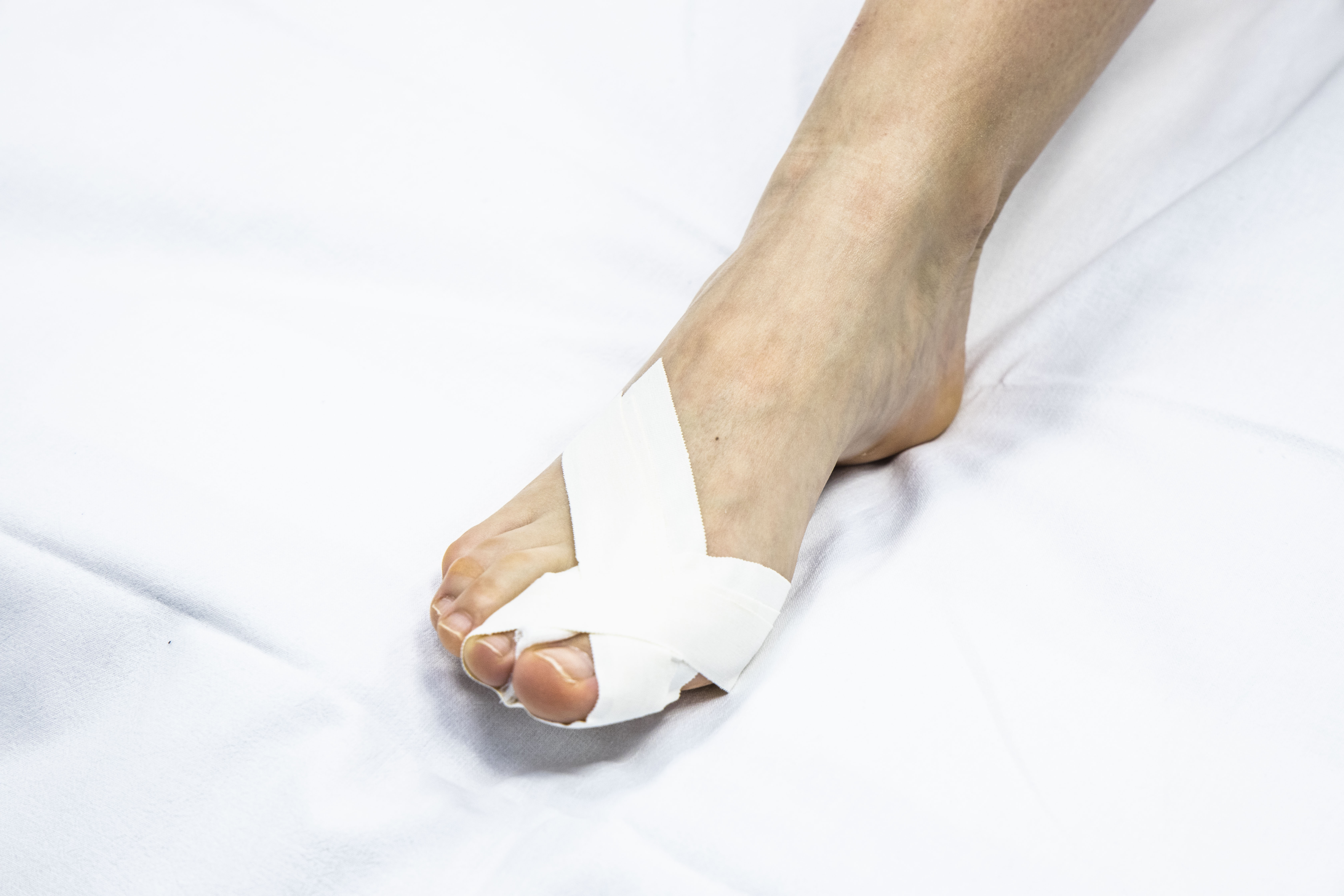 Traitement d'une blessure à l'orteil | AZ Groeninge