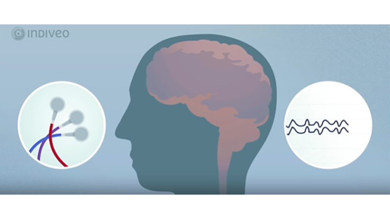 EEG langdurig