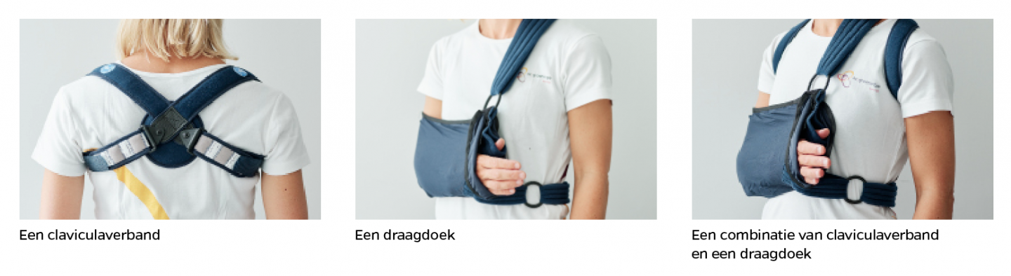 Sleutelbeenbreuk